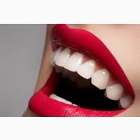 Эффективное аппаратное отбеливание зубов в клинике Эстет Смайл